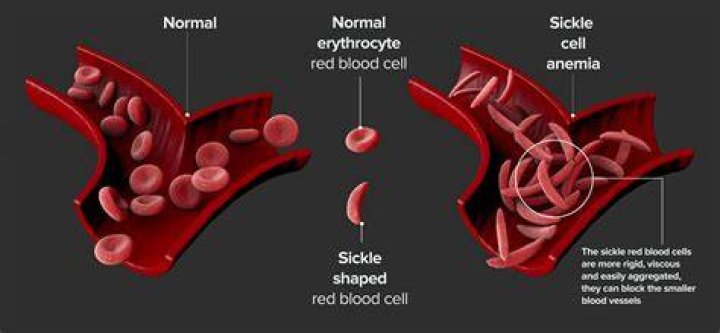 Do reticulocytes have hemoglobin?