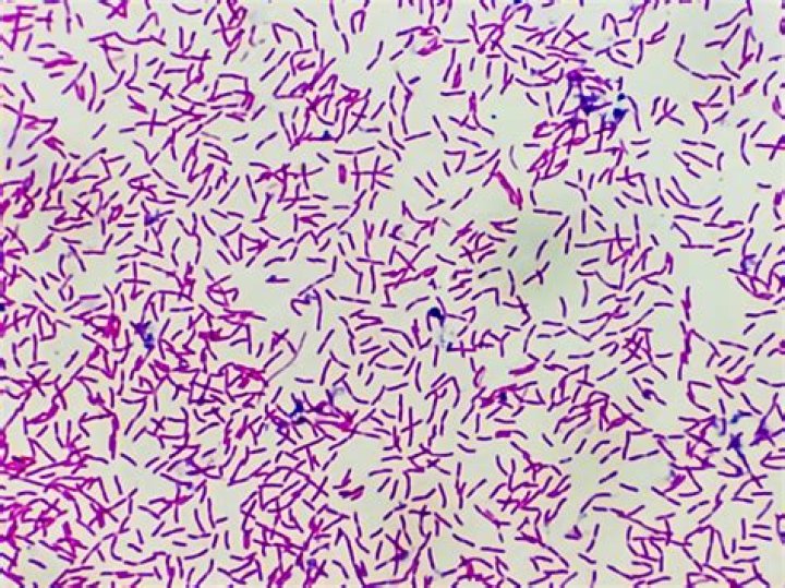 Has a striped appearance when viewed under the microscope?