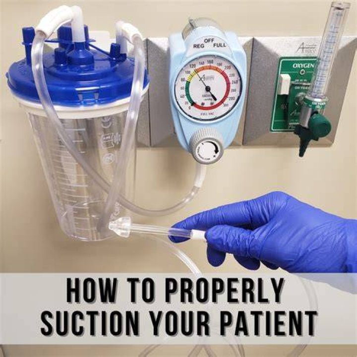How does the suction work?