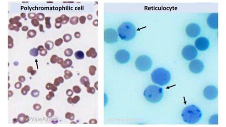 How to count reticulocyte?
