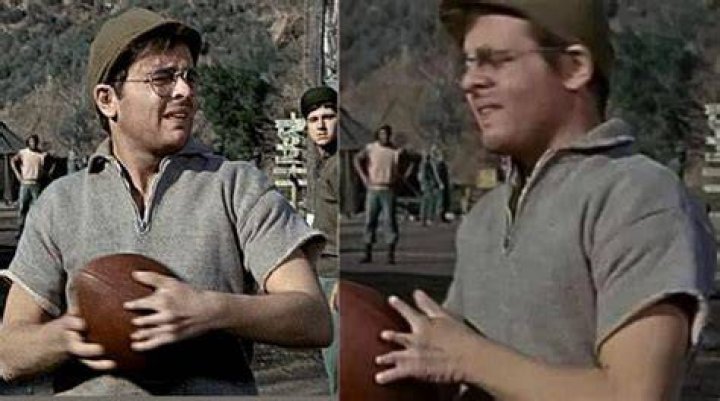 Was radars hand deformed?